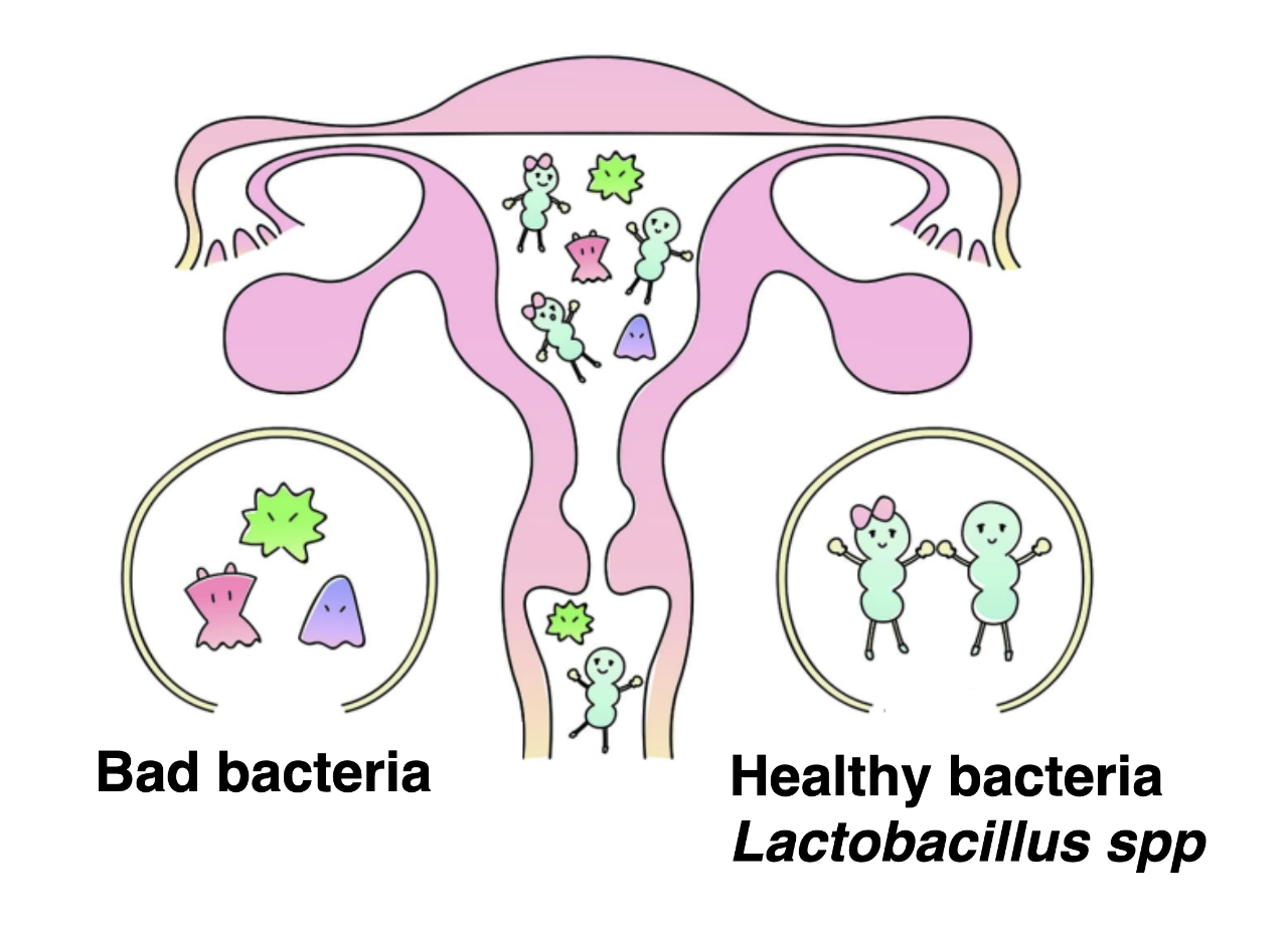 壞細菌 健康細菌 乳酸菌